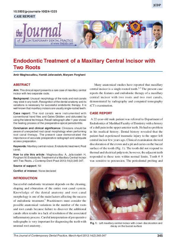 PDF) Endodontic treatment of maxillary central incisor with two