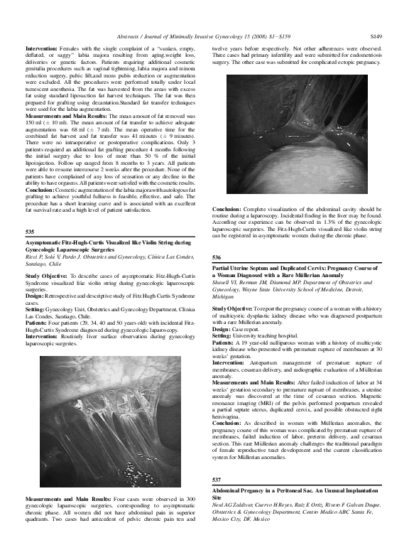 (PDF) Asymptomatic Fitz-Hugh-Curtis Visualized like Violin String ...