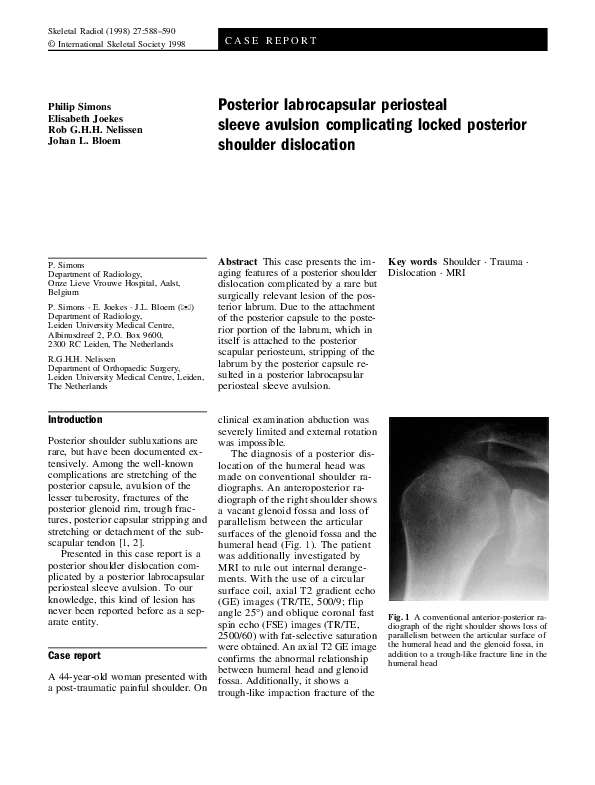 (PDF) Posterior labrocapsular periosteal sleeve avulsion complicating ...