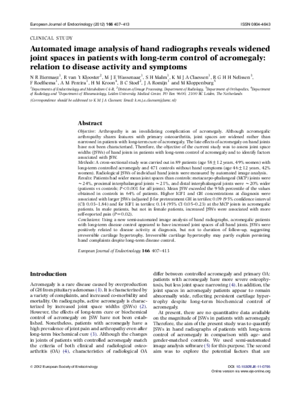 Acromegaly complications picture