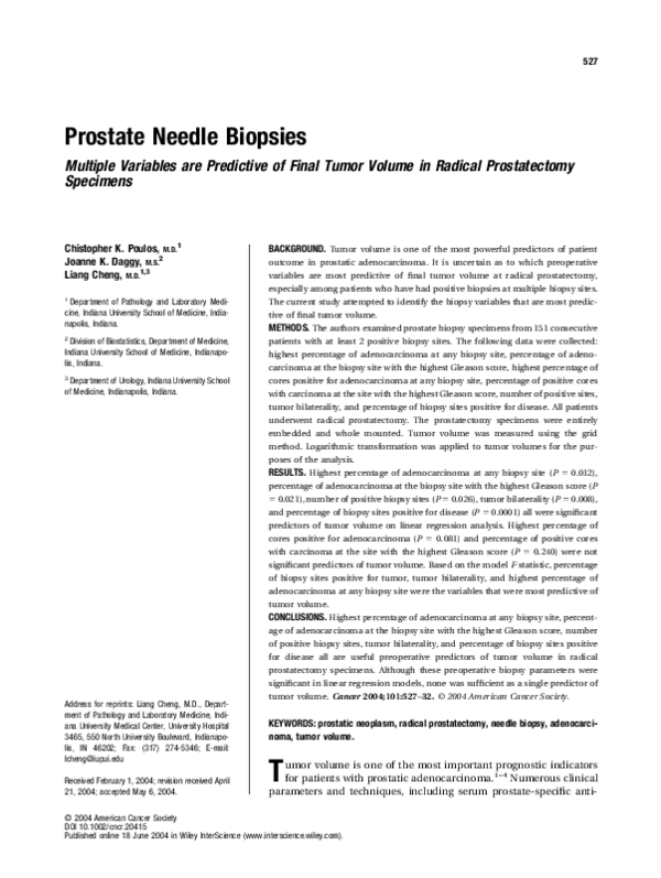 tumori prostata aioma