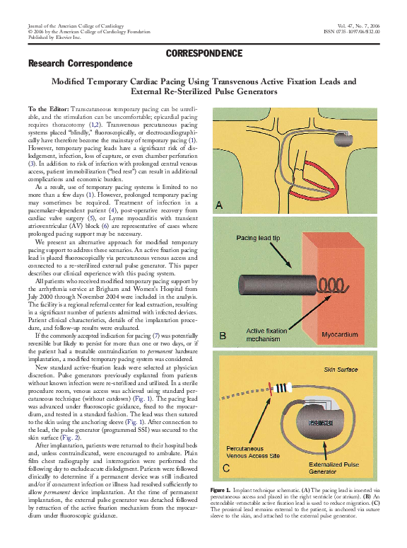 (PDF) Modified Temporary Cardiac Pacing Using Transvenous Active Fixation Leads and External Re