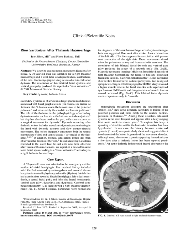 (PDF) Spinocerebellar ataxia type 2 with levodopa-responsive ...