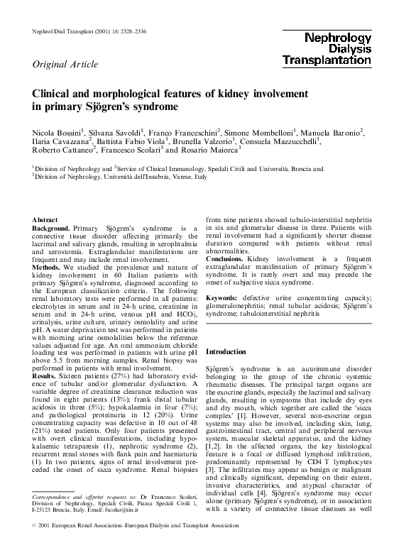 Sjogren's syndrome blindness picture