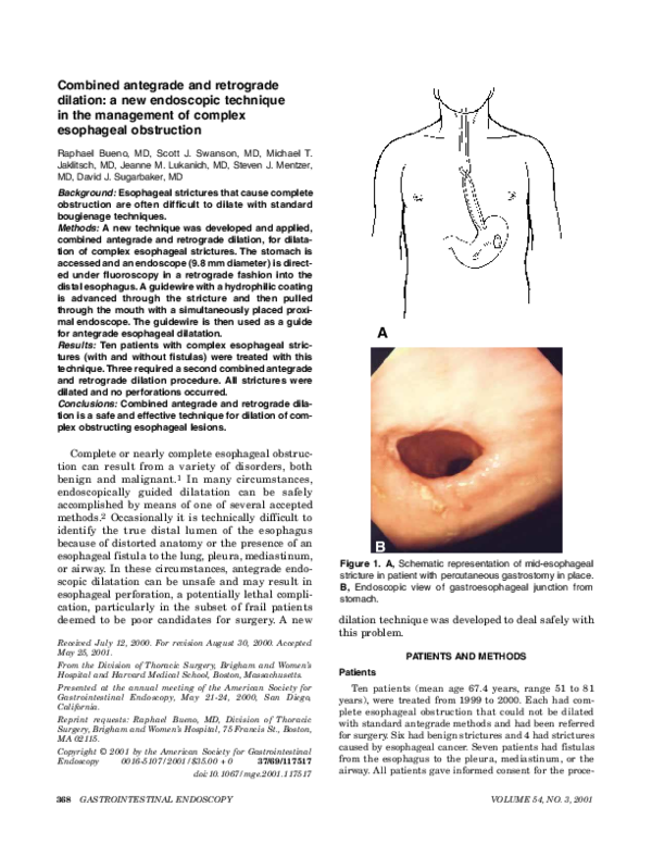 (PDF) Combined antegrade and retrograde dilation A new endoscopic