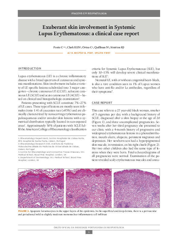 Systemic lupus erythematosus journal pdf picture