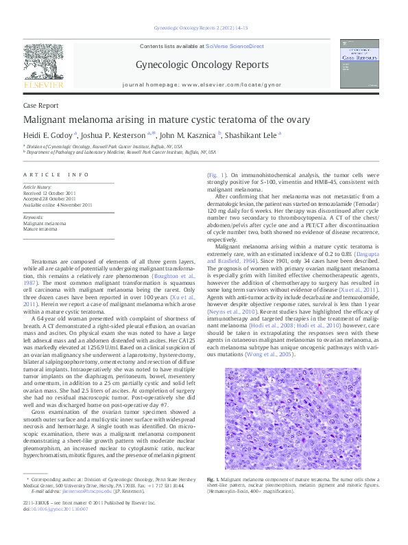 Treatment for melanoma on face image