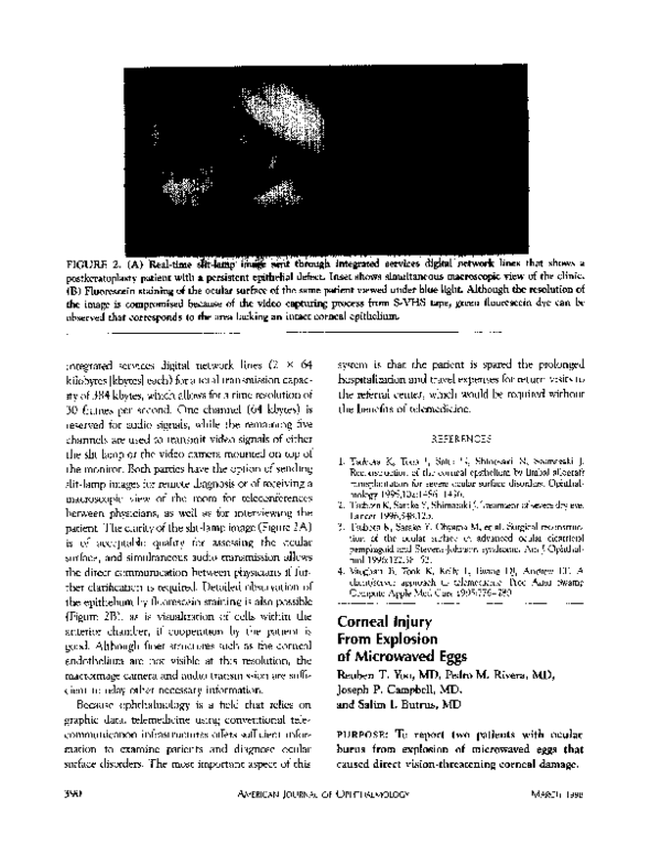 (PDF) Corneal injury from explosion of microwaved eggs