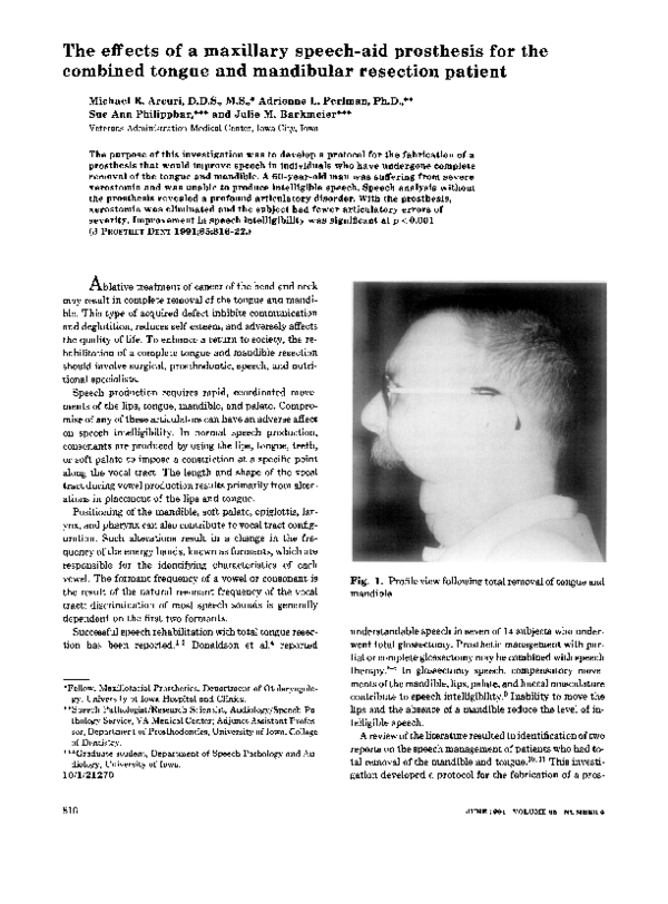(PDF) The effects of a maxillary speechaid prosthesis for the combined