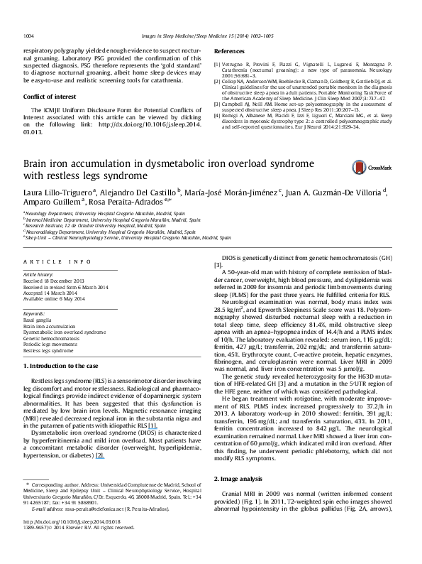 PDF Brain Iron Accumulation In Dysmetabolic Iron Overload Syndrome pdf-brain-iron-accumulation-in-dysmetabolic-iron-overload-syndrome