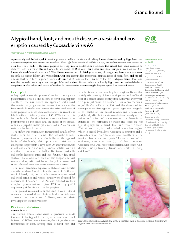 (PDF) Atypical hand, foot, and mouth disease A vesiculobullous