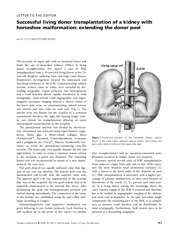 (PDF) Successful living donor transplantation of a kidney with