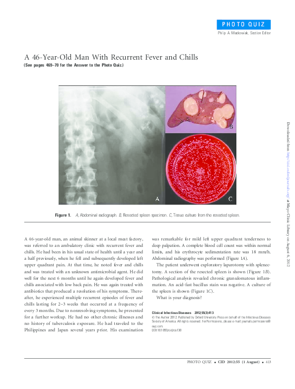 (PDF) 46-Year-Old Man With Recurrent Fever and Chills
