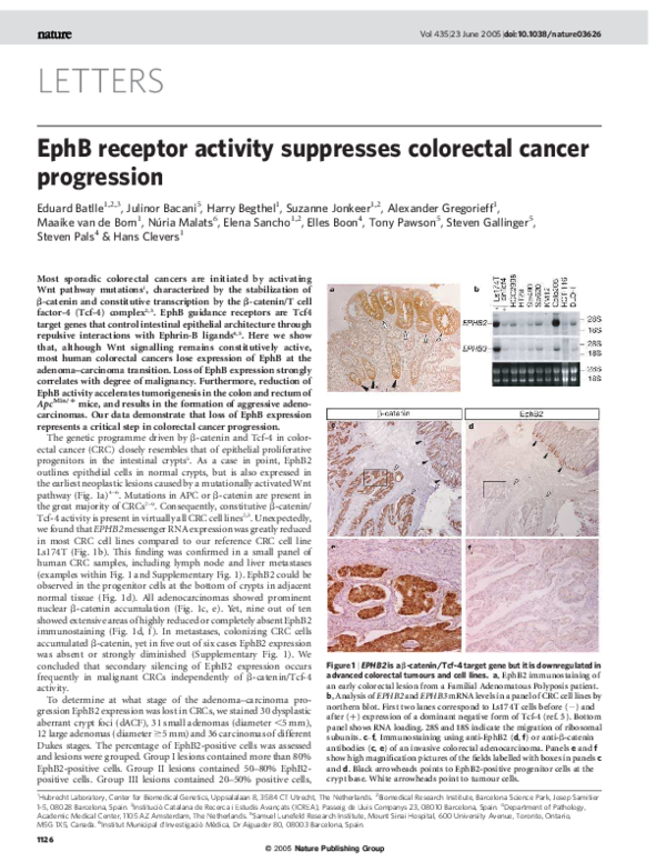 (PDF) EphB receptor activity suppresses colorectal cancer progression