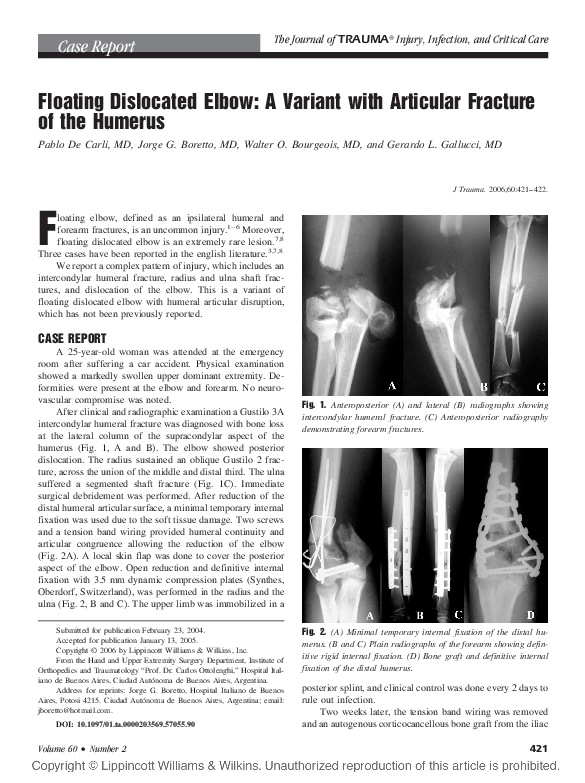(PDF) Floating Dislocated Elbow A Variant with Articular Fracture of