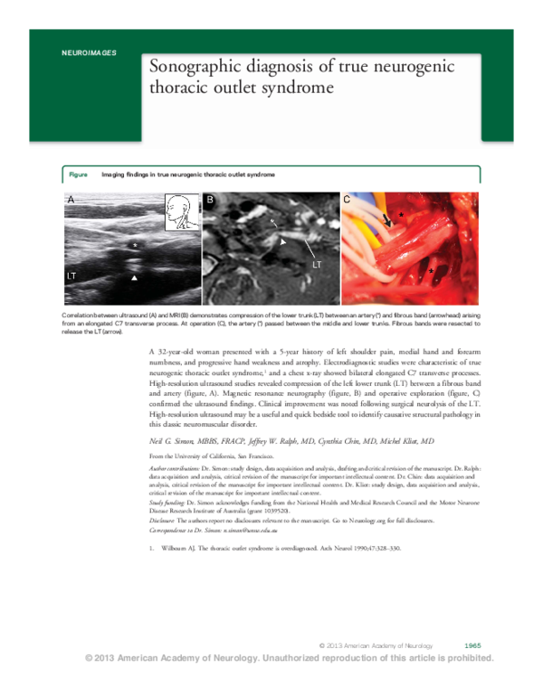 (PDF) Sonographic diagnosis of true neurogenic thoracic outlet syndrome