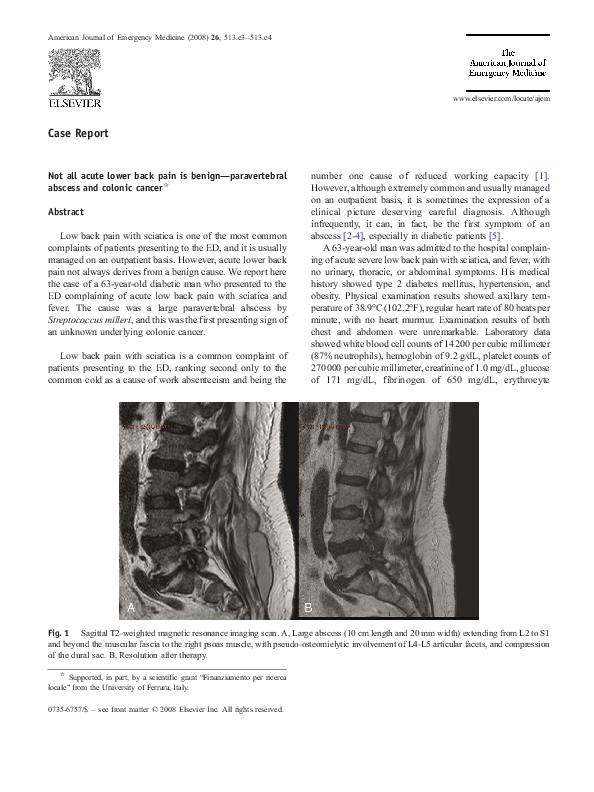 (PDF) Not all acute lower back pain is benign—paravertebral abscess and ...