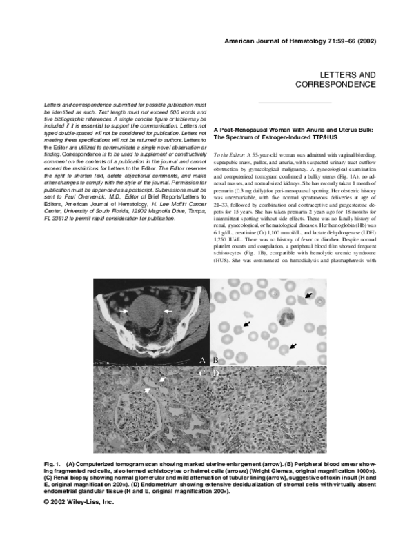 (PDF) Central nervous system relapse in acute promyelocytic leukemia