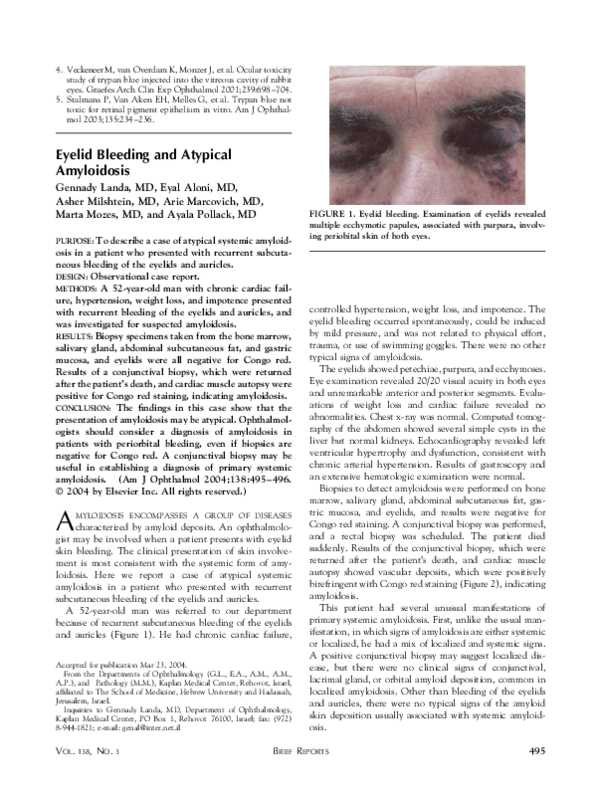 (PDF) Eyelid bleeding and atypical amyloidosis Arie L Marcovich