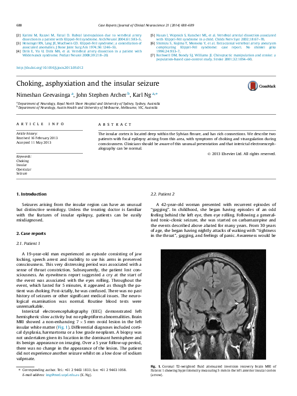 Types of asphyxia picture