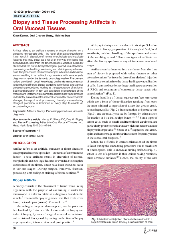 (PDF) Biopsy and Tissue Processing Artifacts in Oral Mucosal Tissues