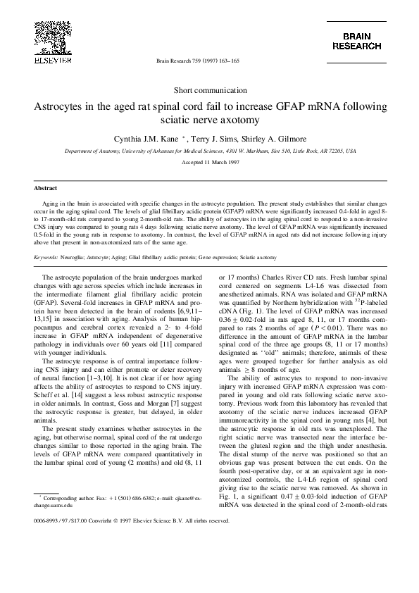 Sciatica research paper picture