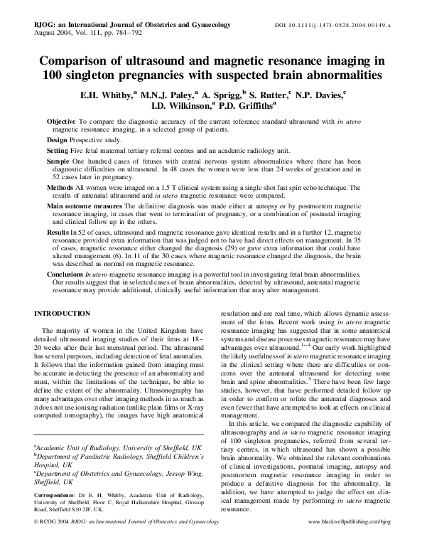 Apert syndrome causes picture