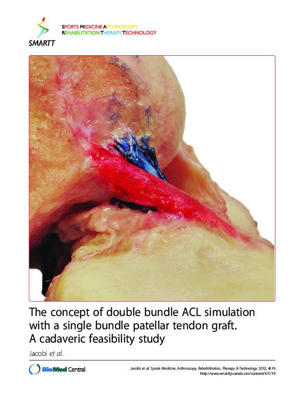 (PDF) The concept of double bundle ACL simulation with a single bundle ...