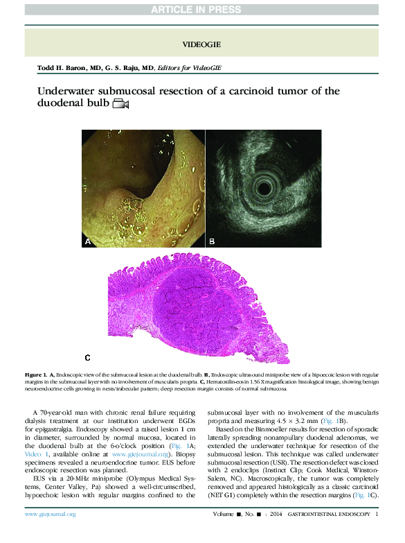 (PDF) Underwater submucosal resection of a carcinoid tumor of the ...