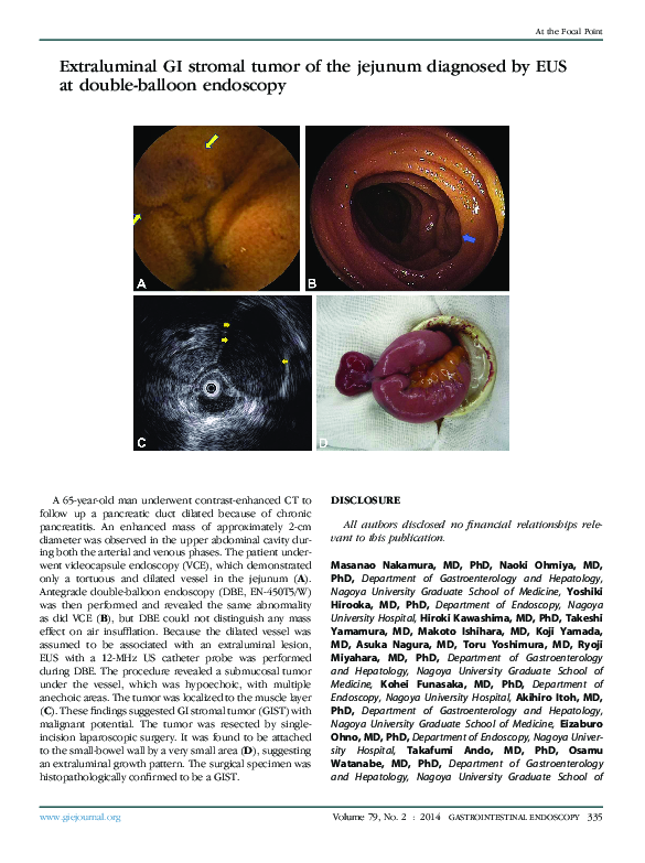 (PDF) Extraluminal GI stromal tumor of the jejunum diagnosed by EUS at ...