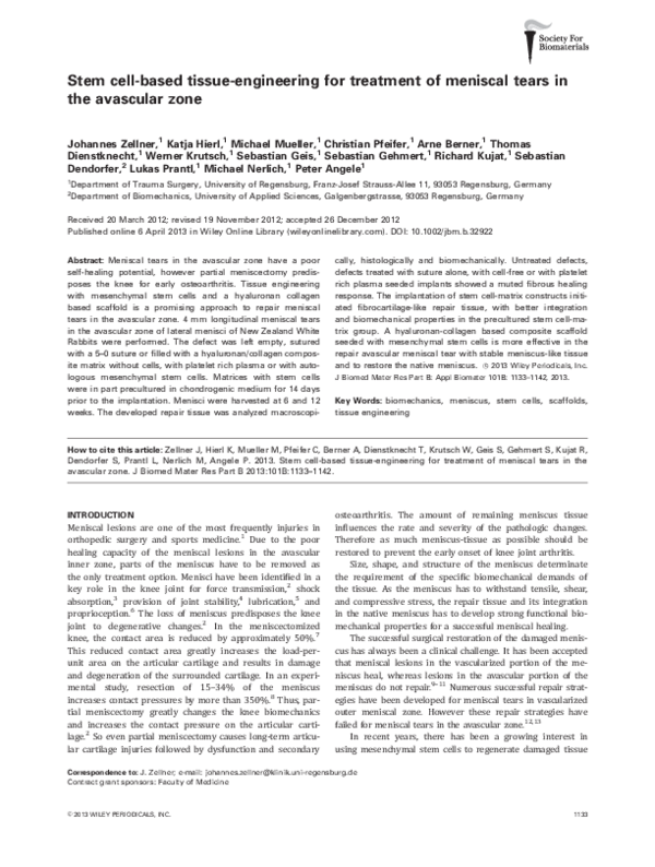 Do meniscal tears cause hemarthrosis image