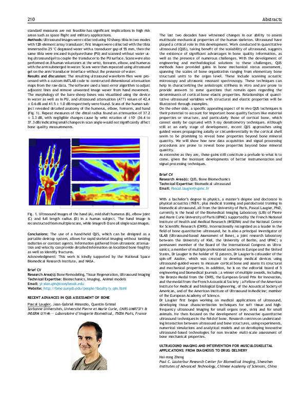 (PDF) Recent advances in QUS assessment of bone