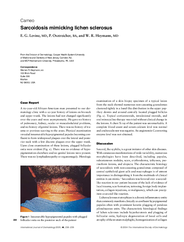 (PDF) Clenched fist syndrome with palmar lichen planus Sema Aytekin