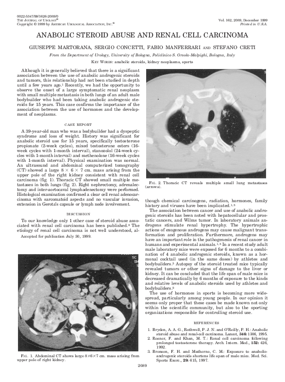 (PDF) Anabolic steroid abuse and renal cell carcinoma F. Manferrari Academia.edu