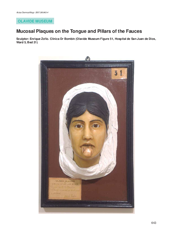 (PDF) Mucosal Plaques on the Tongue and Pillars of the Fauces L