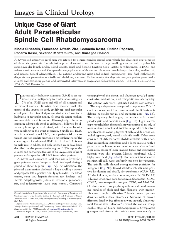 Types of muscle cancers picture