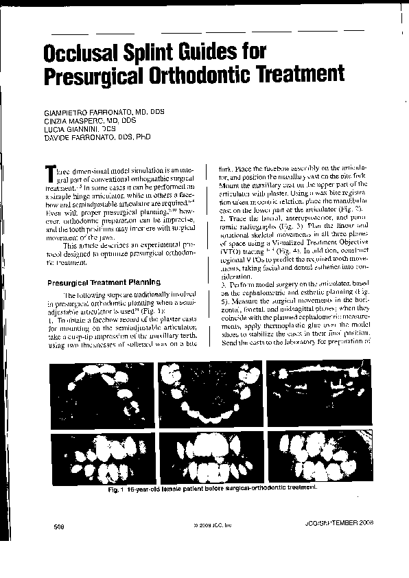 (PDF) Occlusal splint guides for presurgical orthodontic treatment