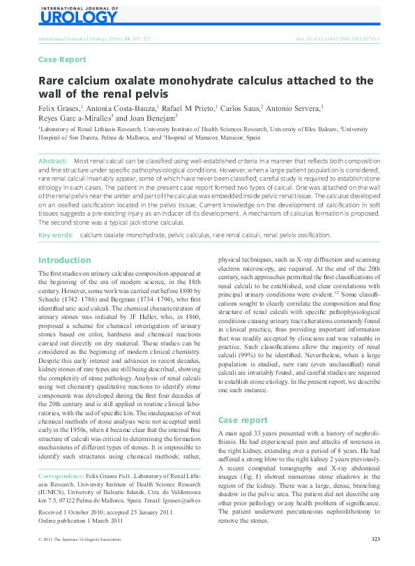 (PDF) Rare calcium oxalate monohydrate calculus attached to the wall of ...