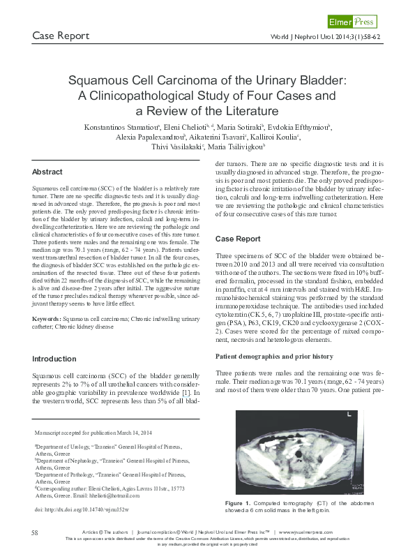 (PDF) Squamous Cell Carcinoma of the Urinary Bladder: A ...