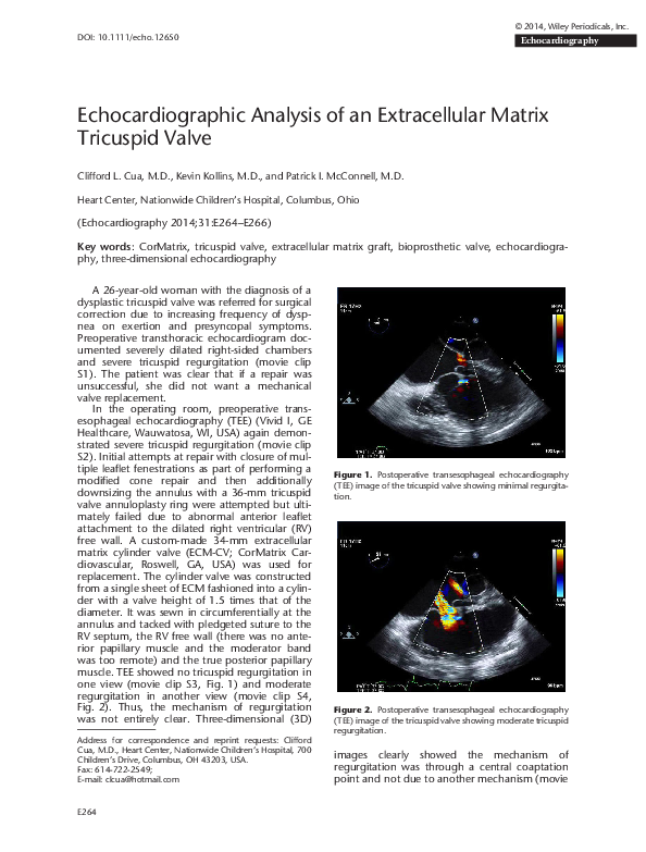 (PDF) ThreeDimensional Image of a Baffle Leak in a Patient with a