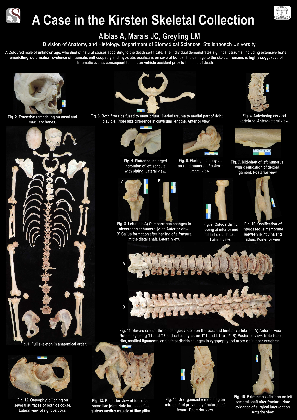 (PDF) Trauma on bones, a case study in the Kirsten Skeletal Collection