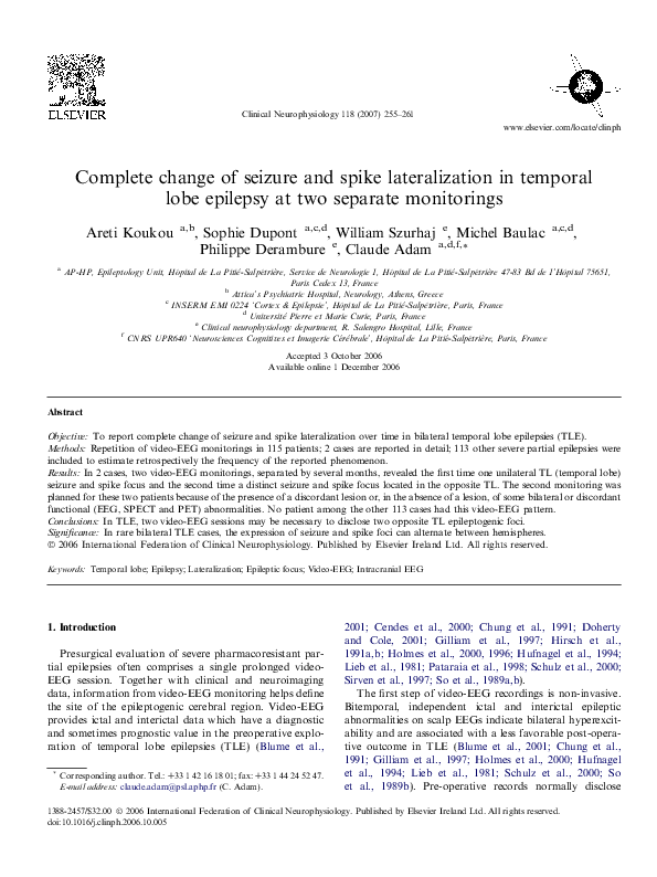(PDF) Complete change of seizure and spike lateralization in temporal ...