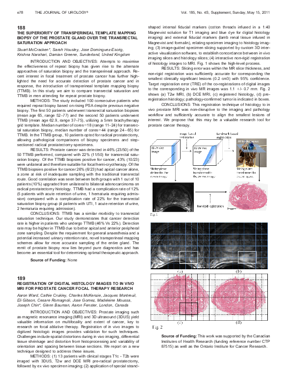 (PDF) 189 REGISTRATION OF DIGITAL HISTOLOGY IMAGES TO IN VIVO MRI FOR ...