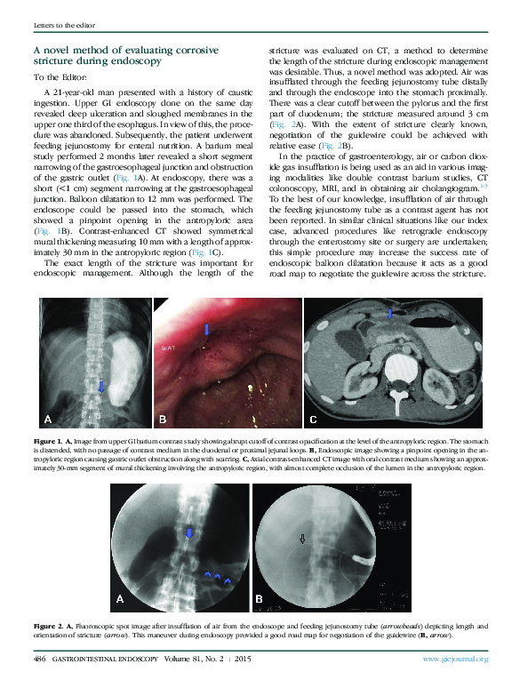 (PDF) A novel method of evaluating corrosive stricture during endoscopy