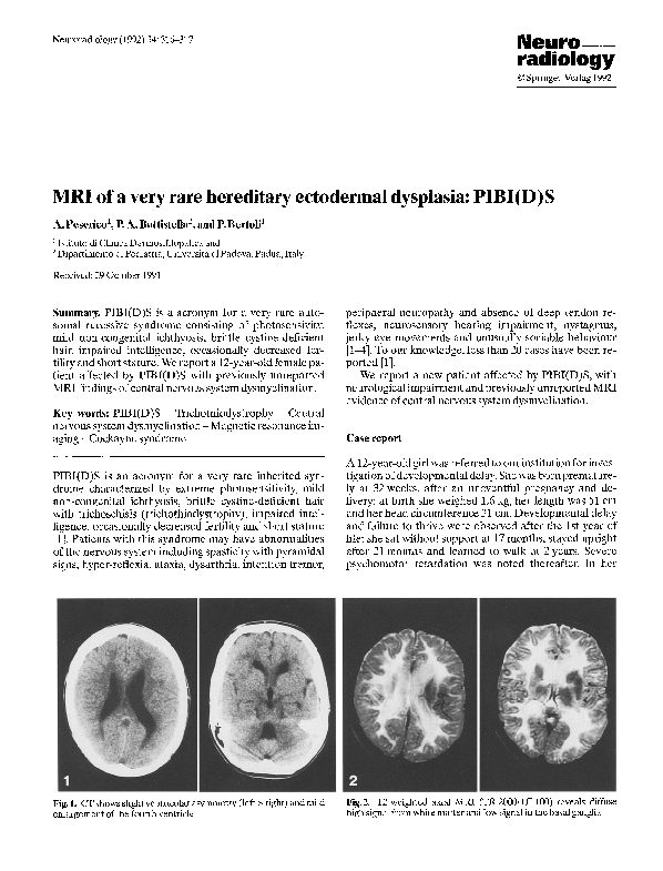 (PDF) MRI of a very rare hereditary ectodermal dysplasia: PIBI(D)S
