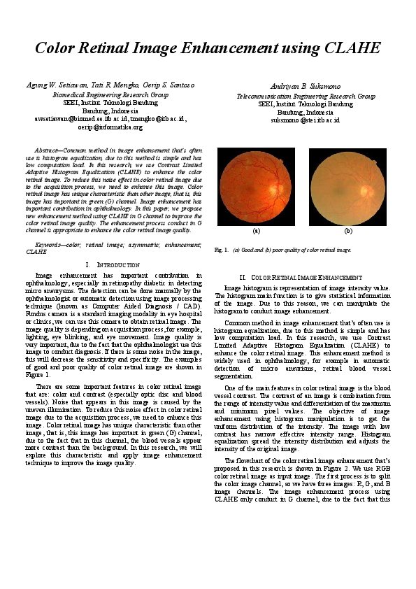 (PDF) Color retinal image enhancement using CLAHE