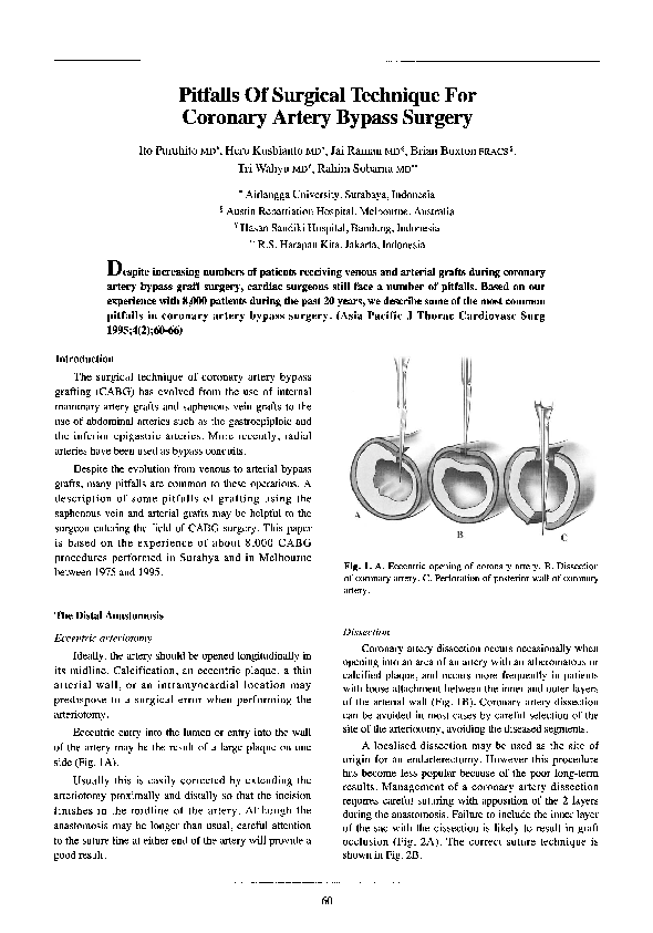 (PDF) Pitfalls of surgical technique for coronary artery bypass surgery