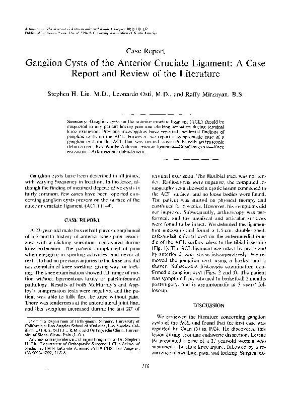 Multiloculated ganglion cyst knee treatment picture