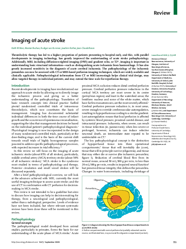 (PDF) Imaging of acute stroke