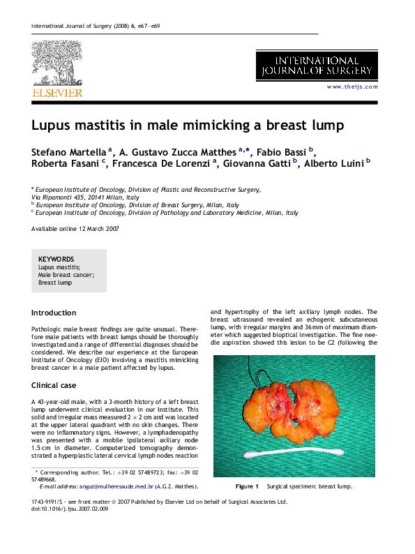 (PDF) Lupus mastitis in male mimicking a breast lump Giovanna Gatti Academia.edu
